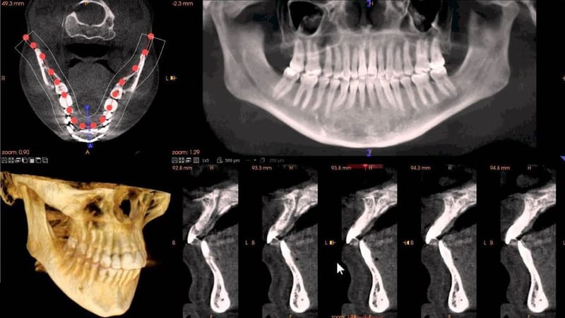 A sample CBCT scan image
