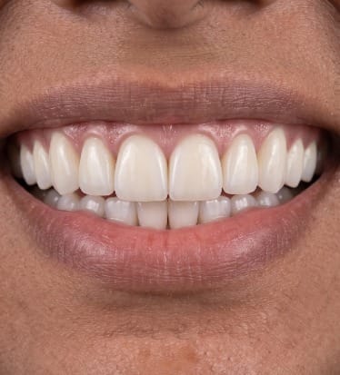 After: Cosmetic dentistry