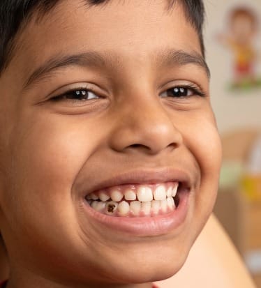 Before: Pediatric dentistry